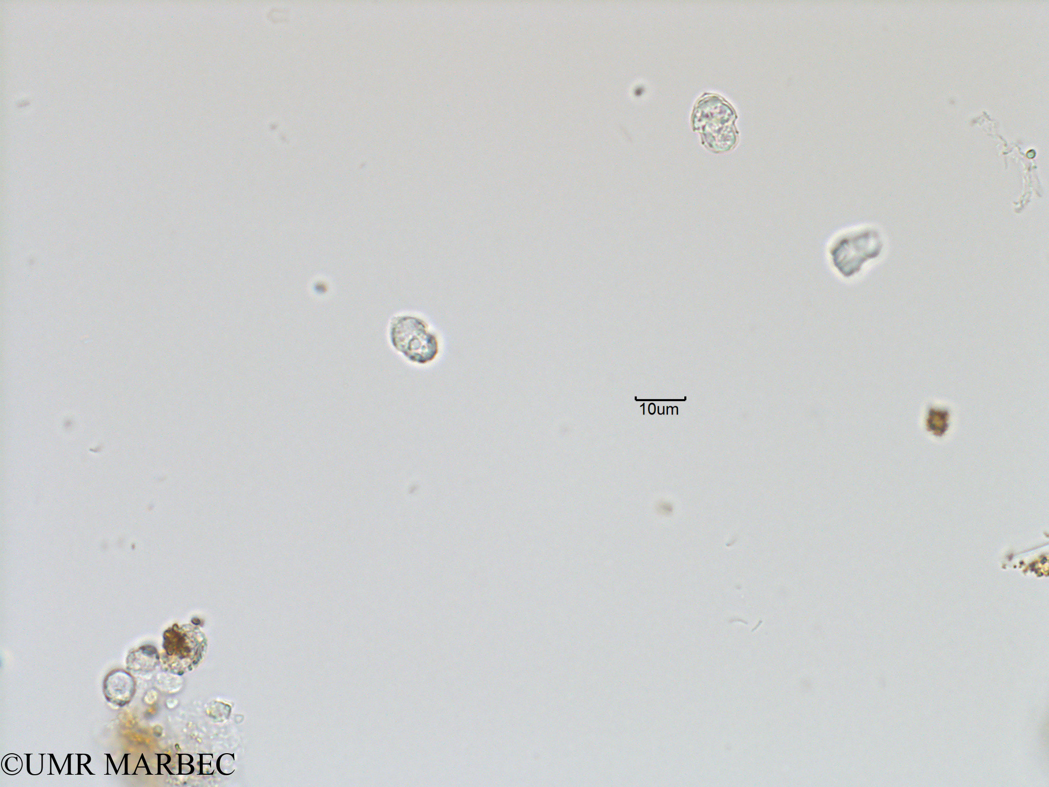 phyto/Bizerte/bizerte_bay/RISCO November 2015/Azadinium spp (Baie_T5-ACW2-dino petit-2).tif(copy).jpg